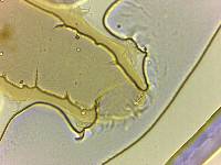Echiniscoides sigismundi image