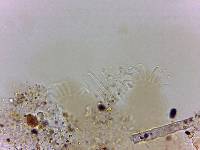 Echiniscoides sigismundi image
