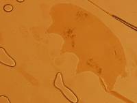 Echiniscoides sigismundi image
