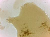 Echiniscoides sigismundi image