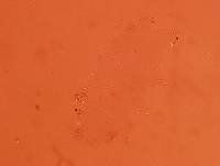 Echiniscoides sigismundi image