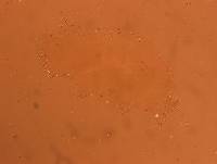 Echiniscoides sigismundi image