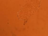 Echiniscoides sigismundi image