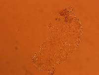 Echiniscoides sigismundi image