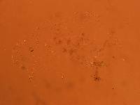 Echiniscoides sigismundi image