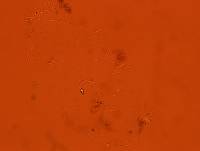 Echiniscoides sigismundi image