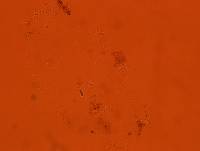 Echiniscoides sigismundi image