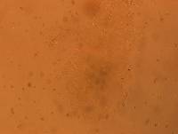 Echiniscoides sigismundi image