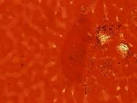 Echiniscoides sigismundi image