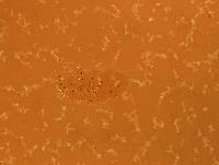 Echiniscoides sigismundi image