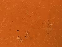 Echiniscoides sigismundi image