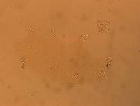 Echiniscoides sigismundi image