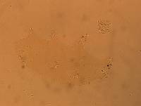Echiniscoides sigismundi image