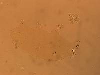 Echiniscoides sigismundi image