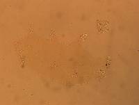 Echiniscoides sigismundi image