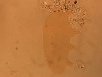 Echiniscoides sigismundi image
