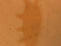 Echiniscoides sigismundi image