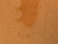 Echiniscoides sigismundi image