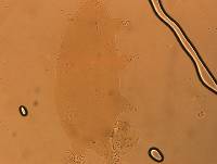 Echiniscoides sigismundi image