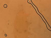 Echiniscoides sigismundi image