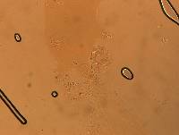 Echiniscoides sigismundi image