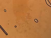 Echiniscoides sigismundi image