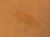 Echiniscoides sigismundi image