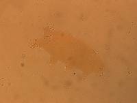 Echiniscoides sigismundi image