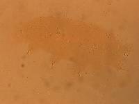 Echiniscoides sigismundi image
