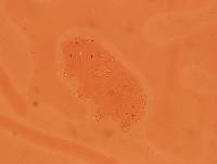 Echiniscoides sigismundi image