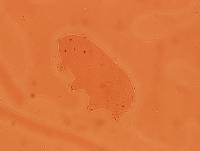 Echiniscoides sigismundi image