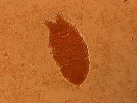 Echiniscus granulatus image