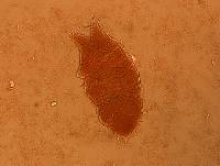 Echiniscus granulatus image