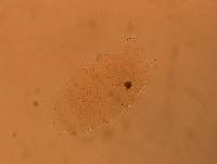 Echiniscus africanus image