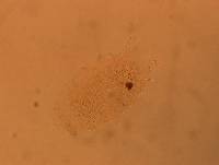 Echiniscus africanus image