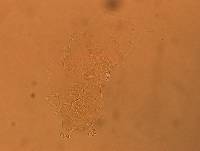 Echiniscus africanus image