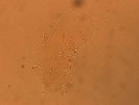 Echiniscus africanus image