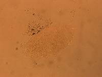 Echiniscus africanus image