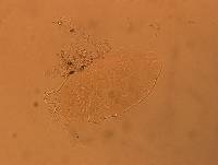Echiniscus africanus image