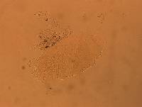 Echiniscus africanus image
