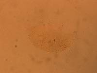 Echiniscus africanus image