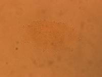Echiniscus africanus image
