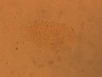 Echiniscus africanus image