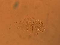 Echiniscus africanus image