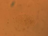 Echiniscus africanus image