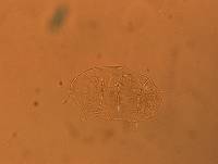 Echiniscus africanus image