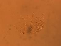 Echiniscus africanus image