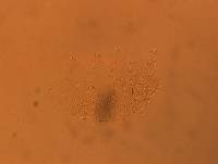 Echiniscus africanus image