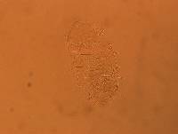 Echiniscus africanus image