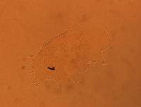 Echiniscus africanus image